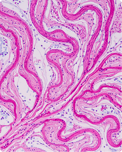 Hydrolysed Collagen vs. Gelatin: Understanding the Differences